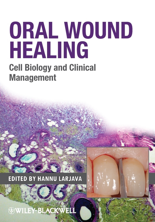 Oral Wound Healing. Cell Biology and Clinical Management