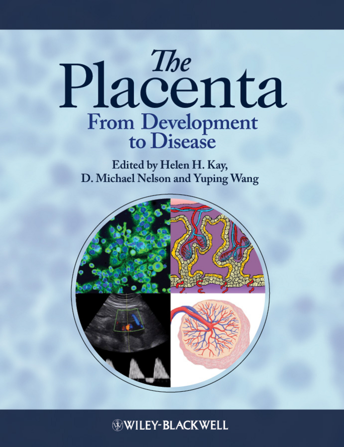 The Placenta. From Development to Disease