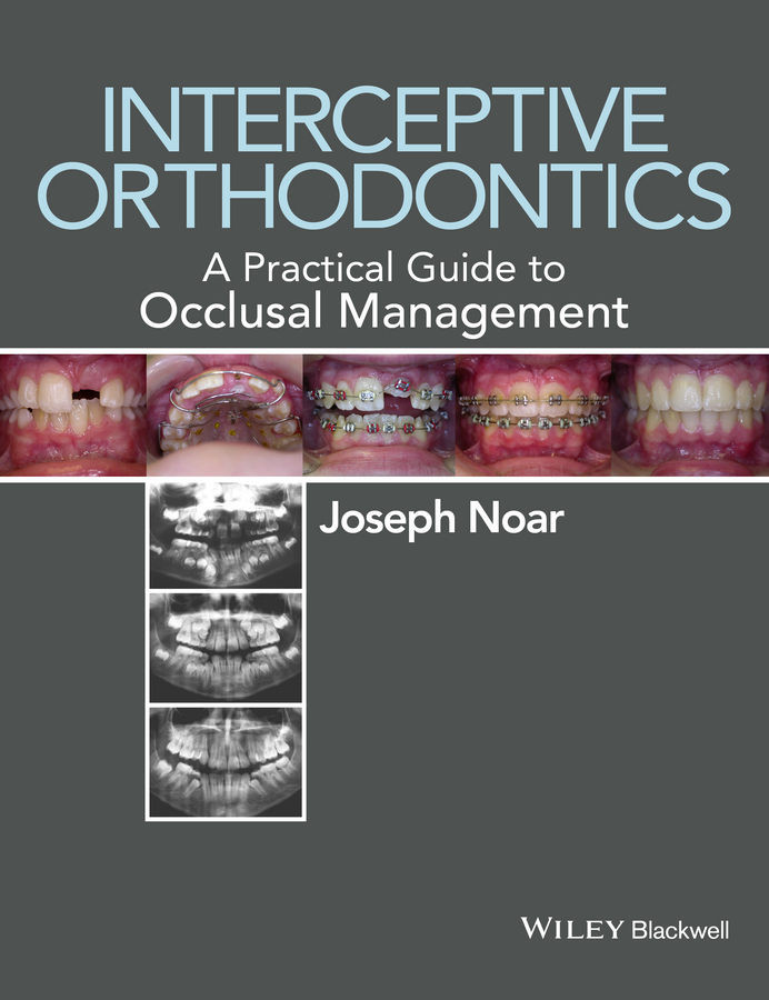 Interceptive Orthodontics. A Practical Guide to Occlusal Management