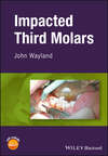 Impacted Third Molars