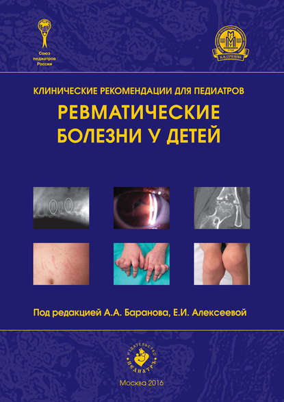 

Ревматические болезни у детей
