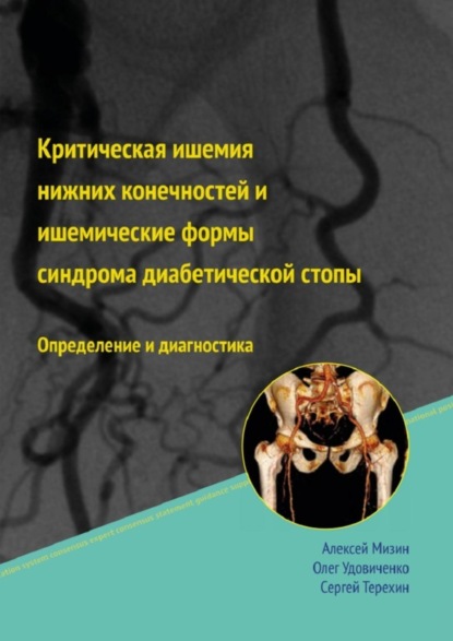 Алексей Мизин — Критическая ишемия нижних конечностей и ишемические формы синдрома диабетической стопы