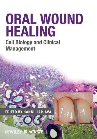 Hannu Larjava — Oral Wound Healing. Cell Biology and Clinical Management