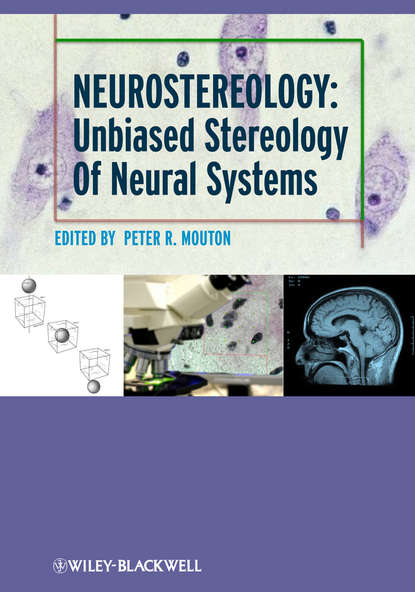 Neurostereology. Unbiased Stereology of Neural Systems (P. Mouton R.). 