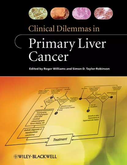 Обложка книги Clinical Dilemmas in Primary Liver Cancer, Williams Roger