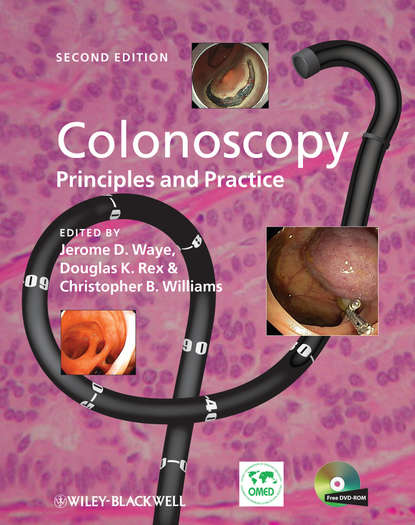 Colonoscopy - Группа авторов
