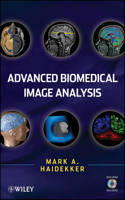 Advanced Biomedical Image Analysis (Mark  Haidekker). 