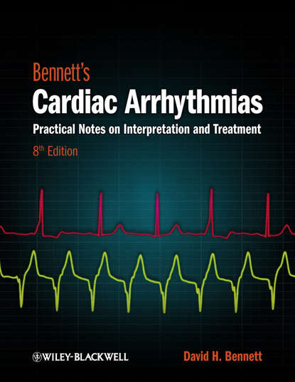 Bennett s Cardiac Arrhythmias