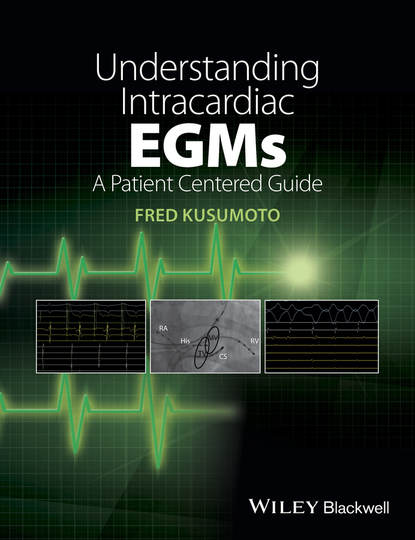 Understanding Intracardiac EGMs - Fred M. Kusumoto