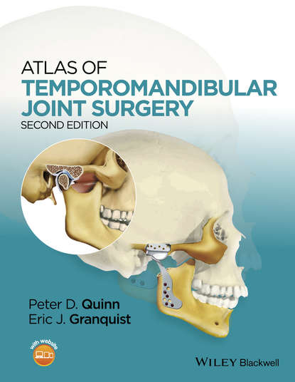 Atlas of Temporomandibular Joint Surgery - Группа авторов