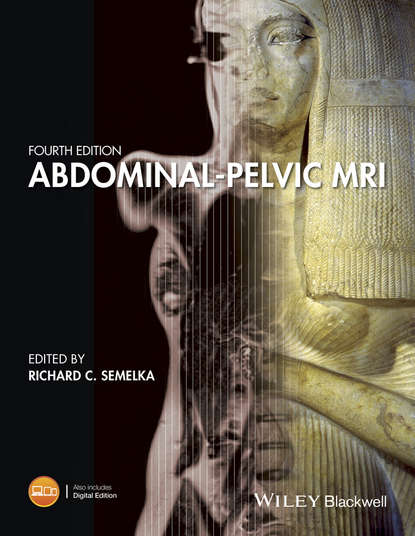 Abdominal-Pelvic MRI - Группа авторов