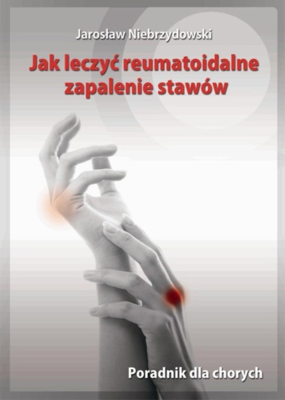 

Jak leczyć reumatoidalne zapalenie stawów. Poradnik dla chorych