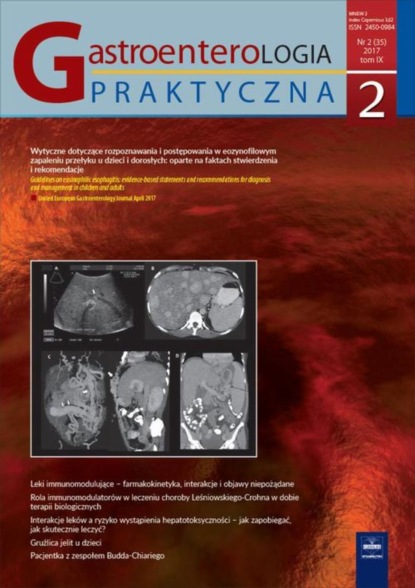 

Gastroenterologia Praktyczna 2/2017