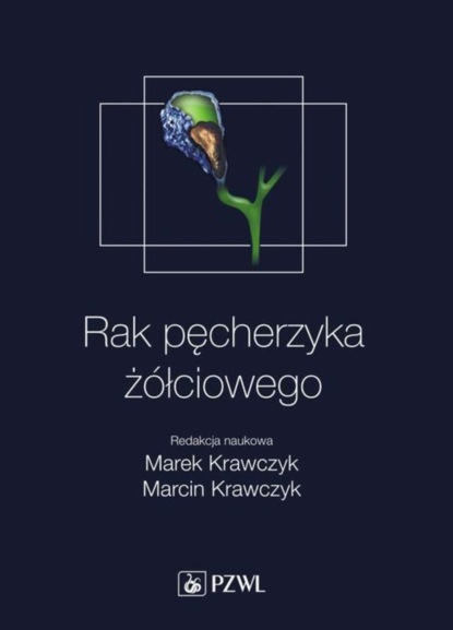 Marek Krawczyk - Rak pęcherzyka żółciowego