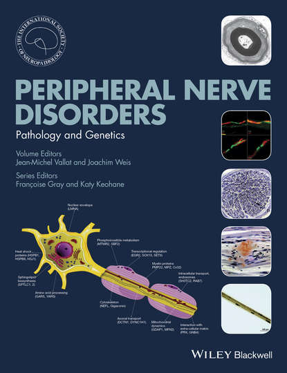 Peripheral Nerve Disorders - Jean-Michel  Vallat