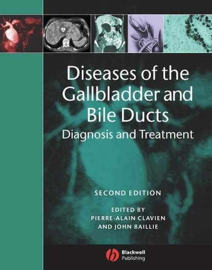 PIERRE-ALAIN  CLAVIEN - Diseases of the Gallbladder and Bile Ducts