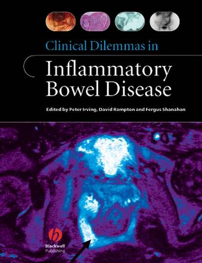 Fergus Shanahan - Clinical Dilemmas in Inflammatory Bowel Disease