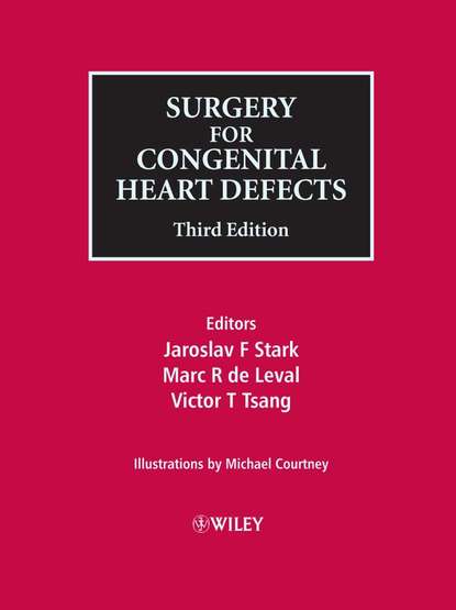 Michael  Courtney - Surgery for Congenital Heart Defects