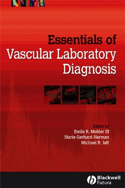 Essentials of Vascular Laboratory Diagnosis - Marie  Gerhard-Herman