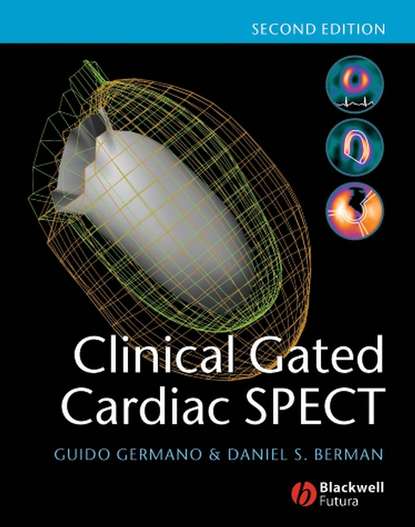 Guido  Germano - Clinical Gated Cardiac SPECT