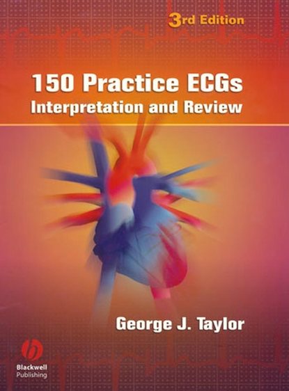 Группа авторов - 150 Practice ECGs