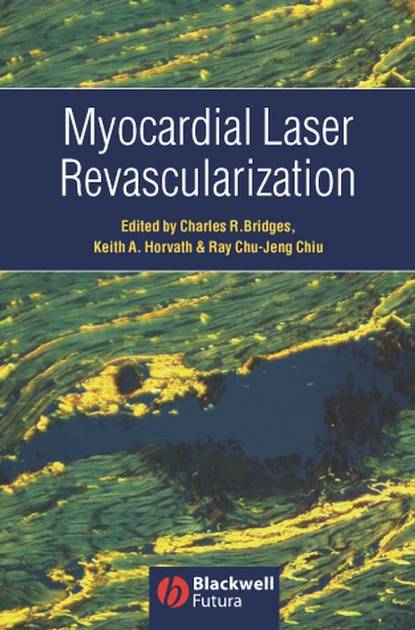 Charles  Bridges - Myocardial Laser Revascularization