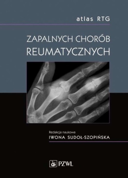 

Atlas RTG zapalnych chorób reumatycznych