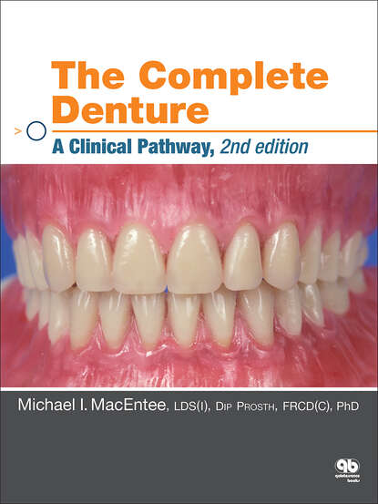 Michael I. MacEntee - The Complete Denture