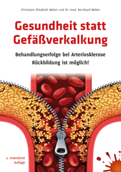 Dr. med. Bernhard Weber — Gesundheit statt Gef??verkalkung