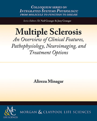 Alireza Minagar — Multiple Sclerosis