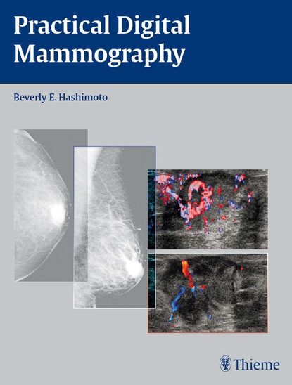 Beverly E. Hashimoto - Practical Digital Mammography