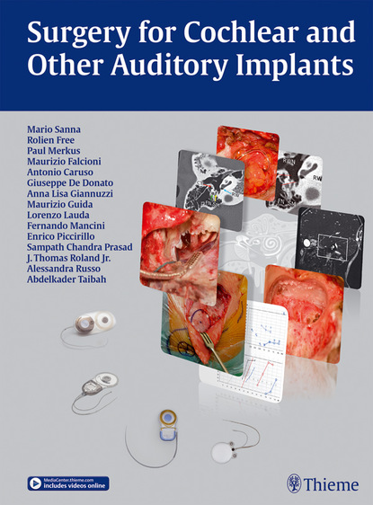 Mario Sanna - Surgery for Cochlear and Other Auditory Implants