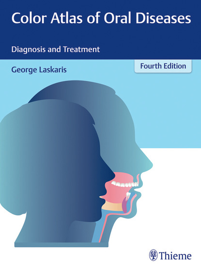 

Color Atlas of Oral Diseases