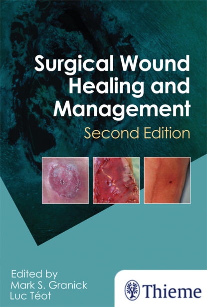 Группа авторов - Surgical Wound Healing and Management