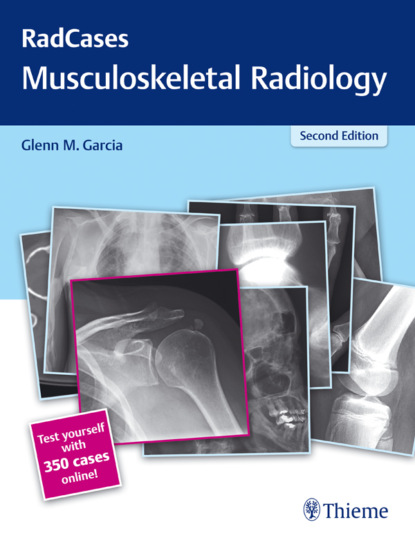 Группа авторов - Radcases Musculoskeletal Radiology