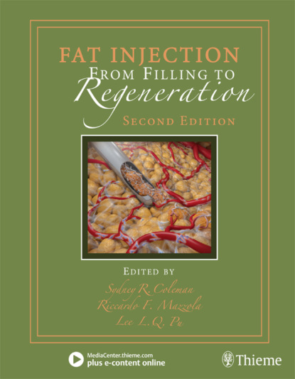 

Fat Injection