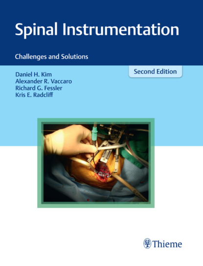 Группа авторов - Spinal Instrumentation