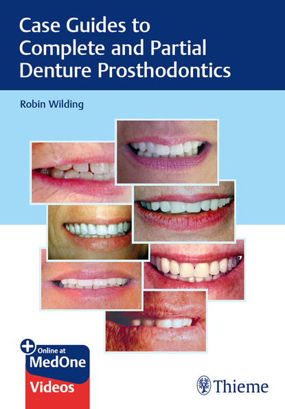 Robin Wilding - Case Guides to Complete and Partial Denture Prosthodontics