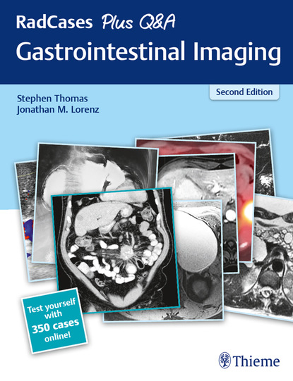 Stephen Thomas G. - RadCases Plus Q&A Gastrointestinal Imaging