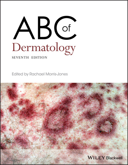 Группа авторов - ABC of Dermatology