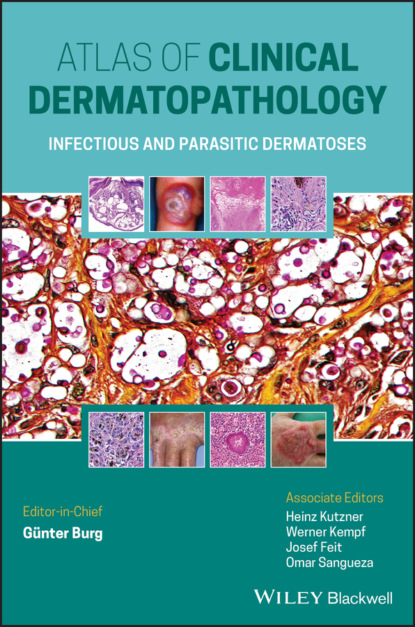 Gunter Burg — Atlas of Clinical Dermatopathology