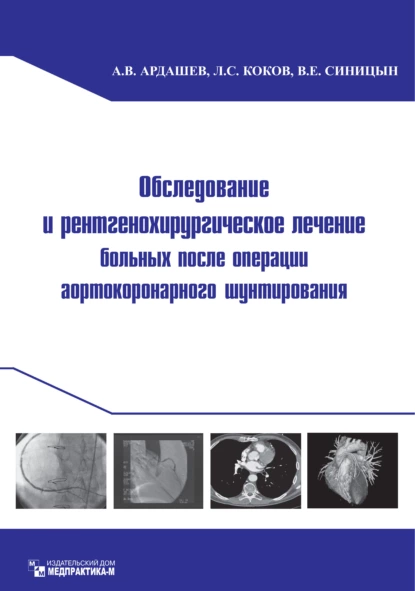 Обложка книги Обследование и рентгенохирургическое лечение больных после операции аортокоронарного шунтирования, В. Е. Синицын