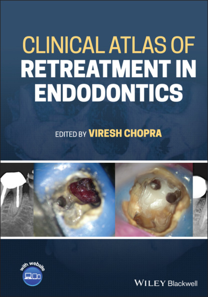 Группа авторов - Clinical Atlas of Retreatment in Endodontics