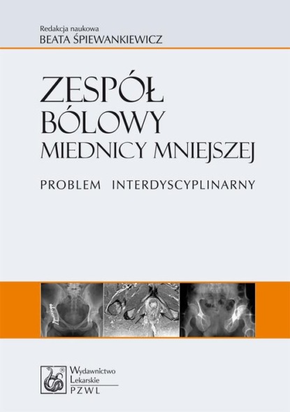 

Zespół bólowy miednicy mniejszej. Problem interdyscyplinarny