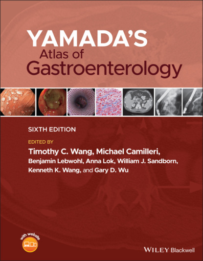 Yamada's Atlas of Gastroenterology - Группа авторов