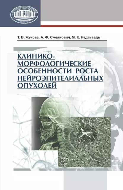 Обложка книги Клинико-морфологические особенности роста нейроэпителиальных опухолей, Т. В. Жукова