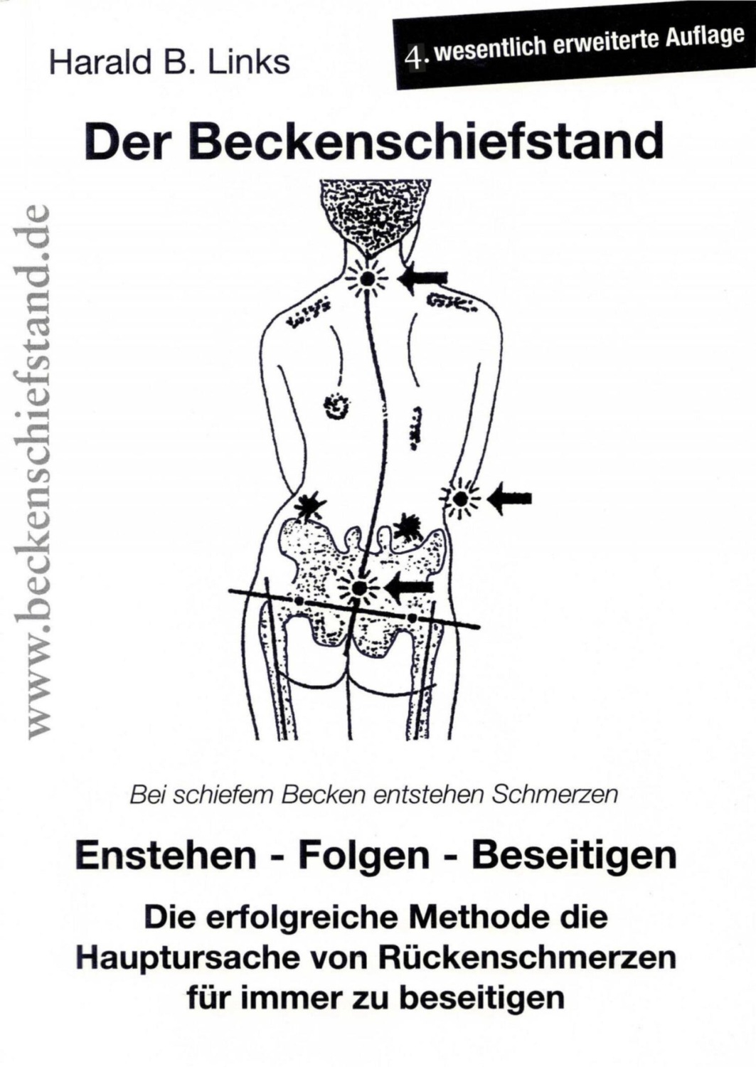 Der Beckenschiefstand Ebook Kostenlos Online Lesen Oder Downloaden